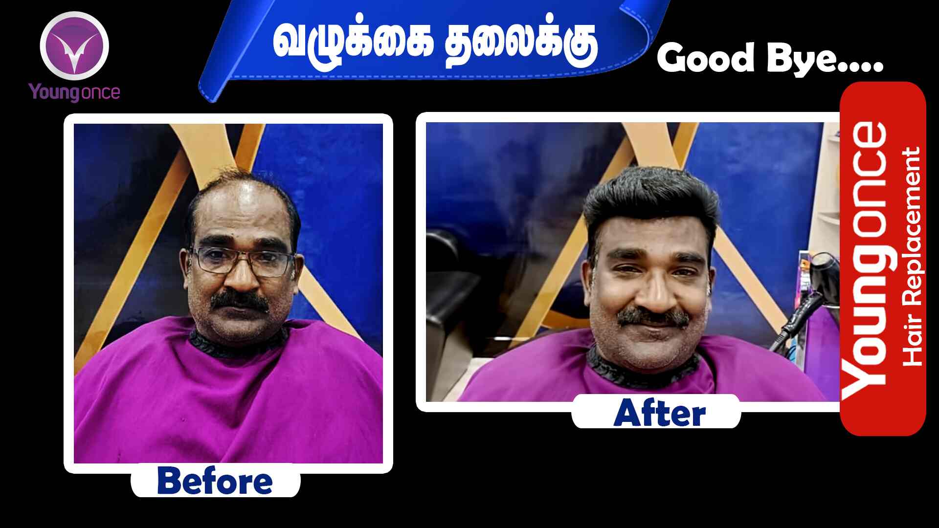 Young Once in Angammal Colony,Salem Best Hair Treatment Clinics in