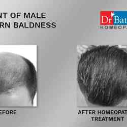Dr. Batras Healthcare in Satara City - Book Appointment Online - Best Gynaecologist & Obstetrician Doctors in Satara - Justdial Dr. Batras Healthcare in Satara City - Book Appointment Online - Best Gynaecologist & Obstetrician Doctors in Satara - Justdial