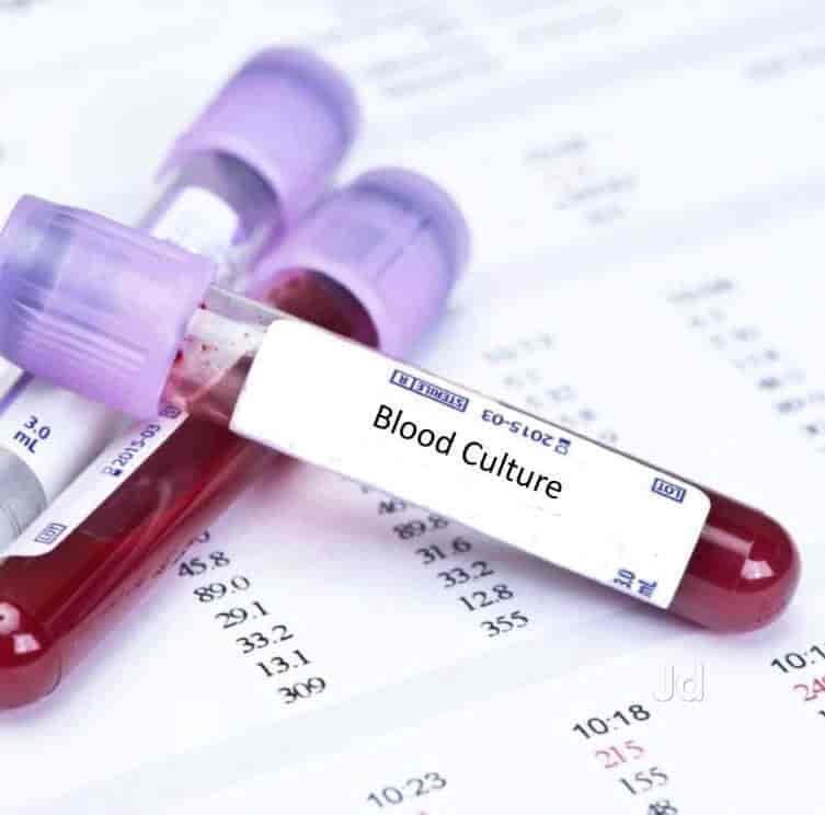 Sreshta Diagnostics in Vijayawada Best Pathology Labs in Vijayawada