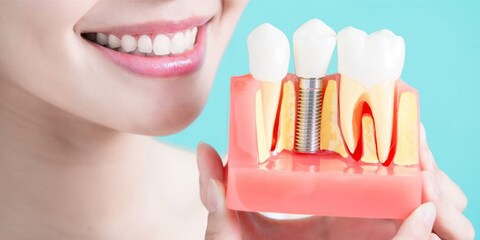 How To Sell price for teeth cleaning