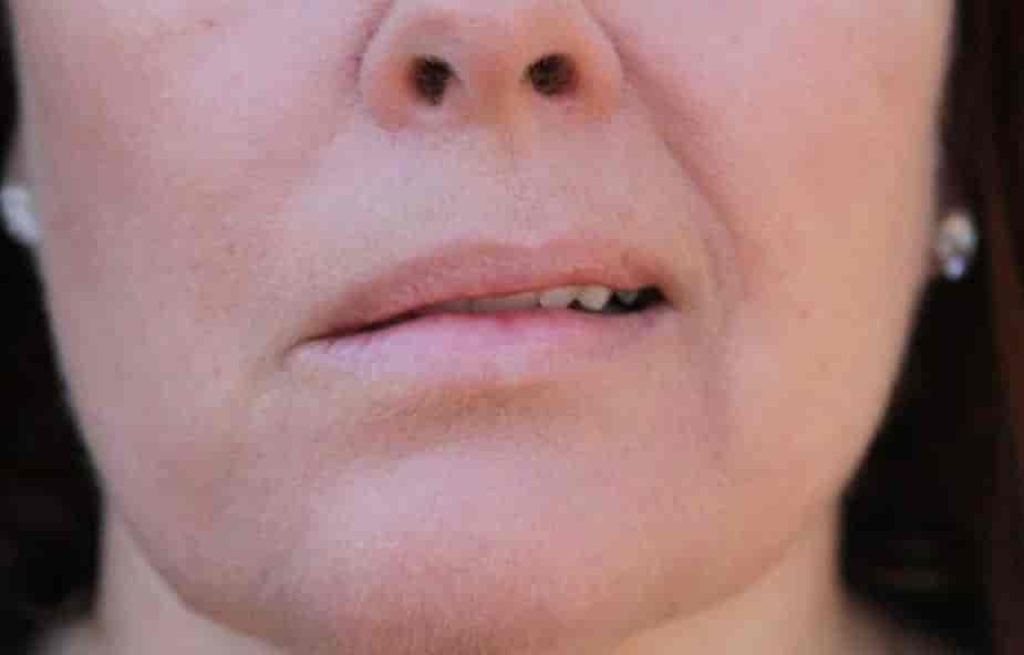 Trigeminal Neuralgia-Causes-Best treatment Option | Homeopathic | Best Homeopathic Doctor in Pakistan | Dr Qaisar Ahmed MD, DHMS