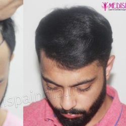 Columbiya Aesthetics in Viman Nagar,Pune - Best Hair Transplant Clinics in Pune - Justdial Columbiya Aesthetics in Viman Nagar,Pune - Best Hair Transplant Clinics in Pune - Justdial