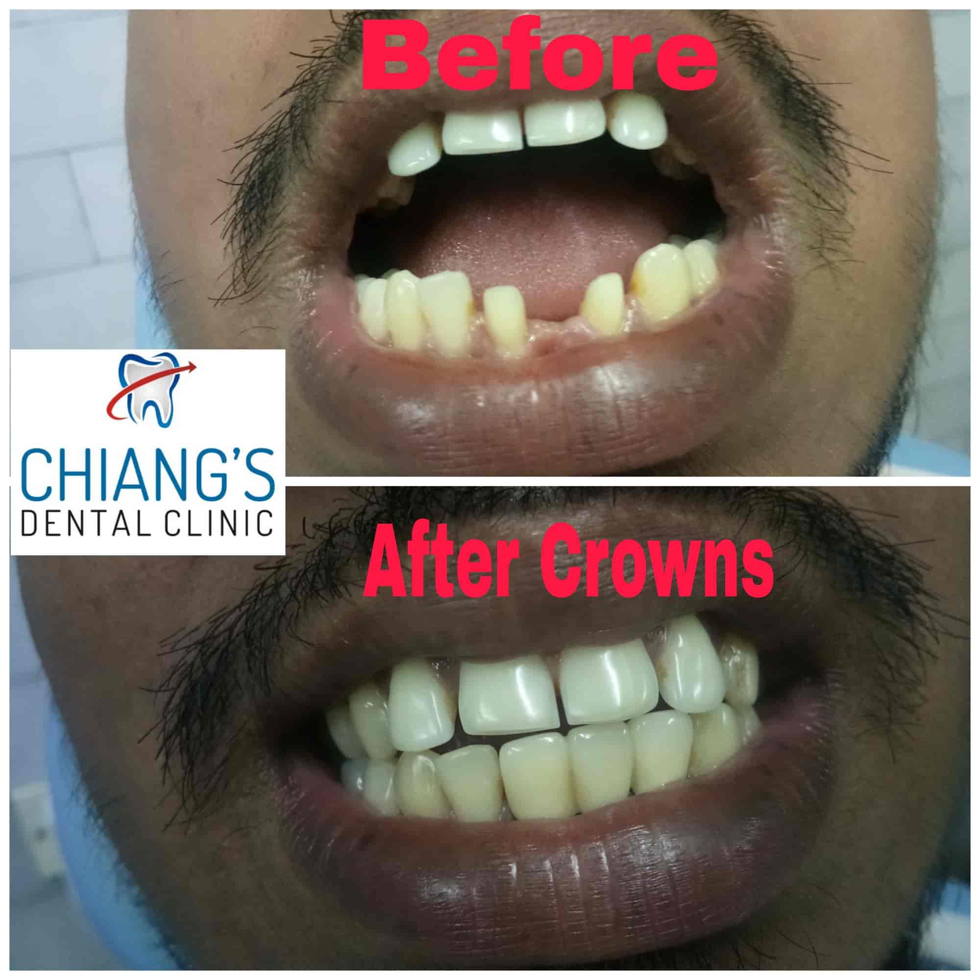 ☺︎ Paano Mag-Switch ng Account sa Advance Server ng MLBB | TikTok