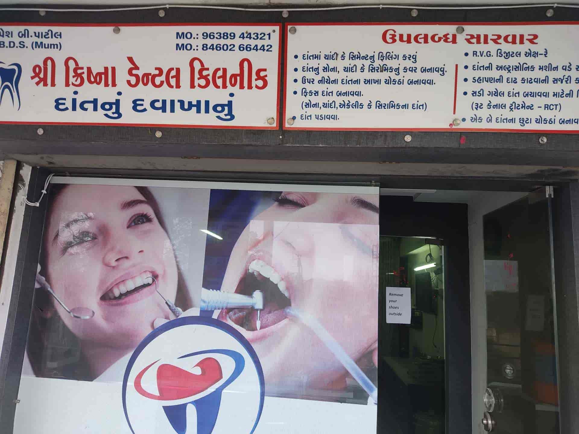 OMG! The Best front tooth composite fillings Ever!