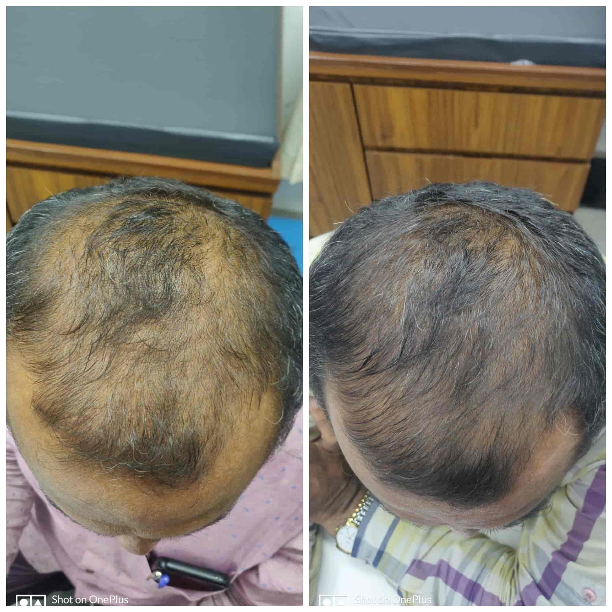 Om Clinic & Skin Care in Bombay Market,Surat Best Skin Care Clinics