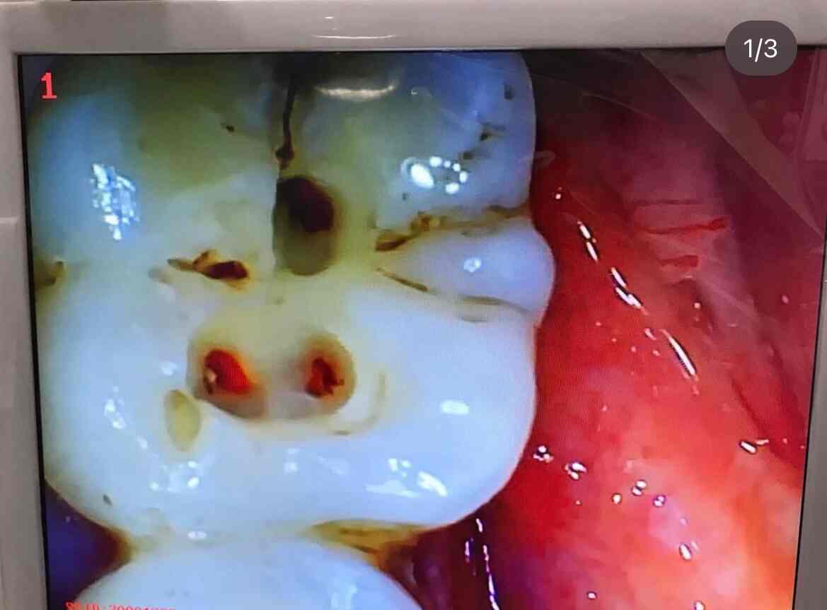 Dental Solutions in Bamroli Road,Surat Best Dental Clinics in Surat