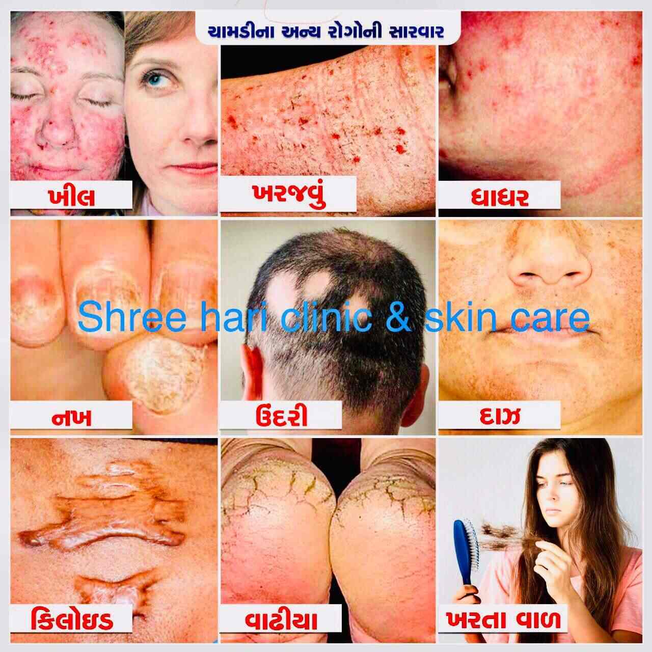 Shree Hari Clinic & Skin Care in Dabholi,Surat Book Appointment