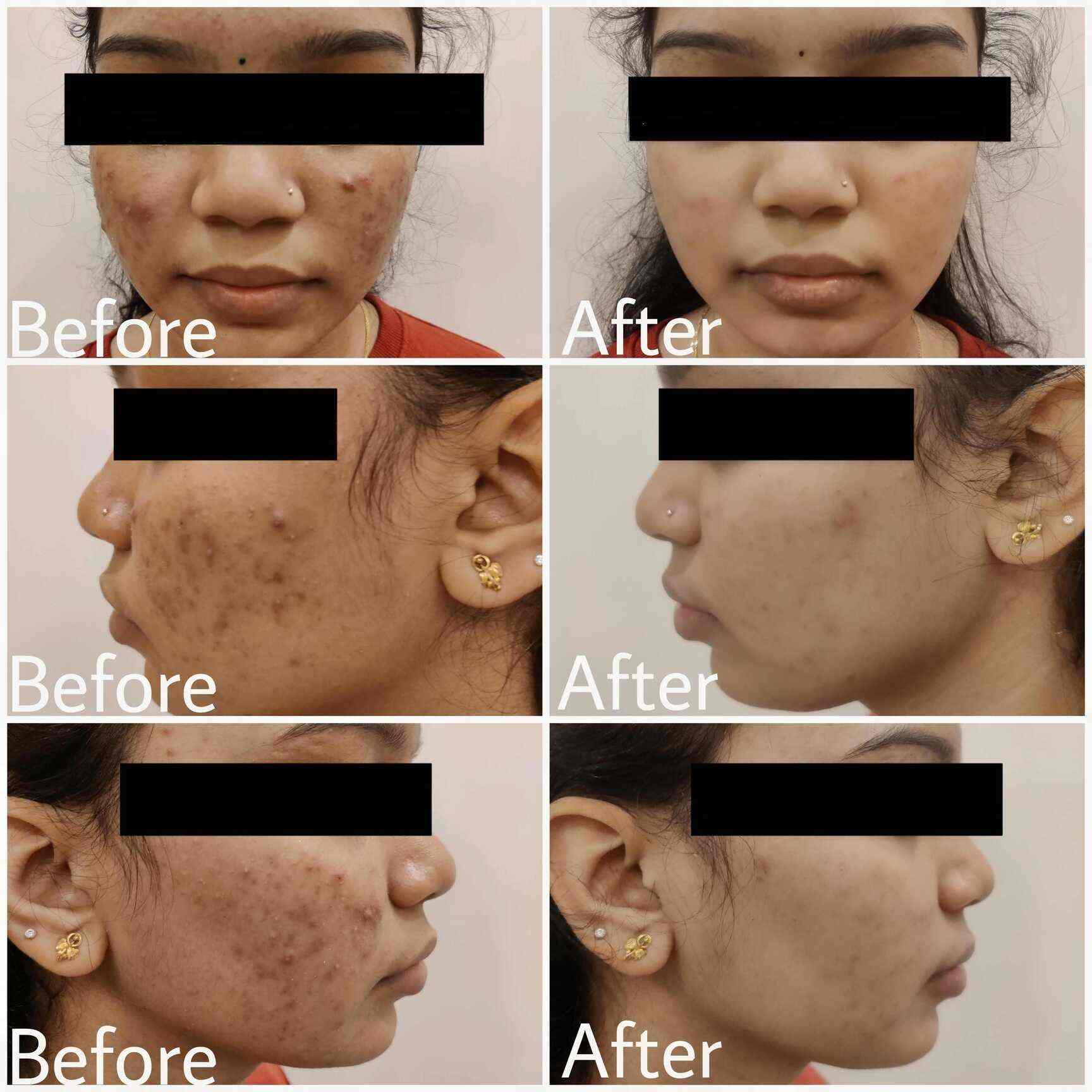 Top Dermatologists in Dombivli Phase 1, Mumbai Best Skin Specialist