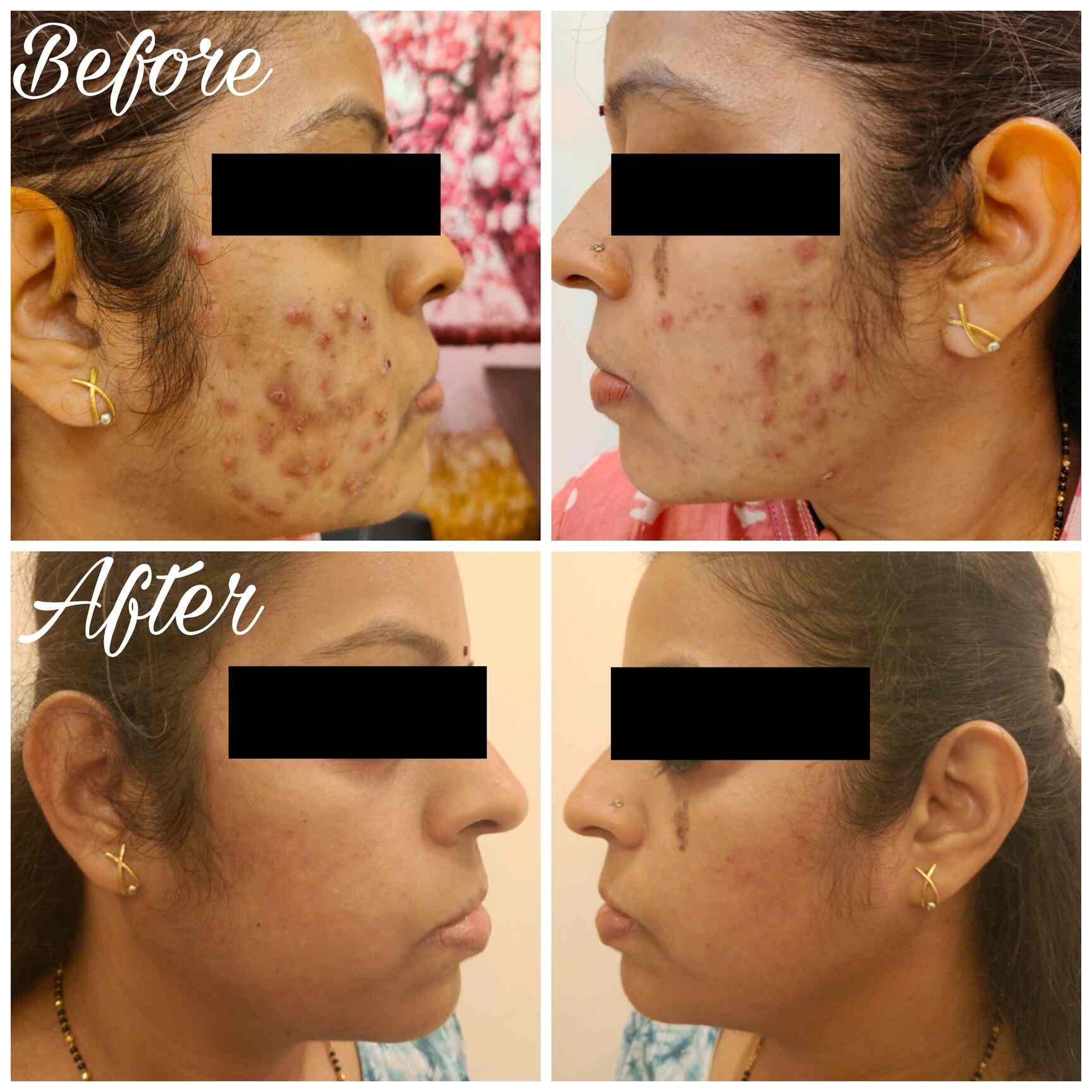 Top Dermatologists in Dombivli Phase 1, Mumbai Best Skin Specialist