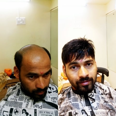 Kishor Hair Replacement in Thane West,Mumbai - Best Non Surgical Hair Replacement Services in Mumbai - Justdial Kishor Hair Replacement in Thane West,Mumbai - Best Non Surgical Hair Replacement Services in Mumbai - Justdial
