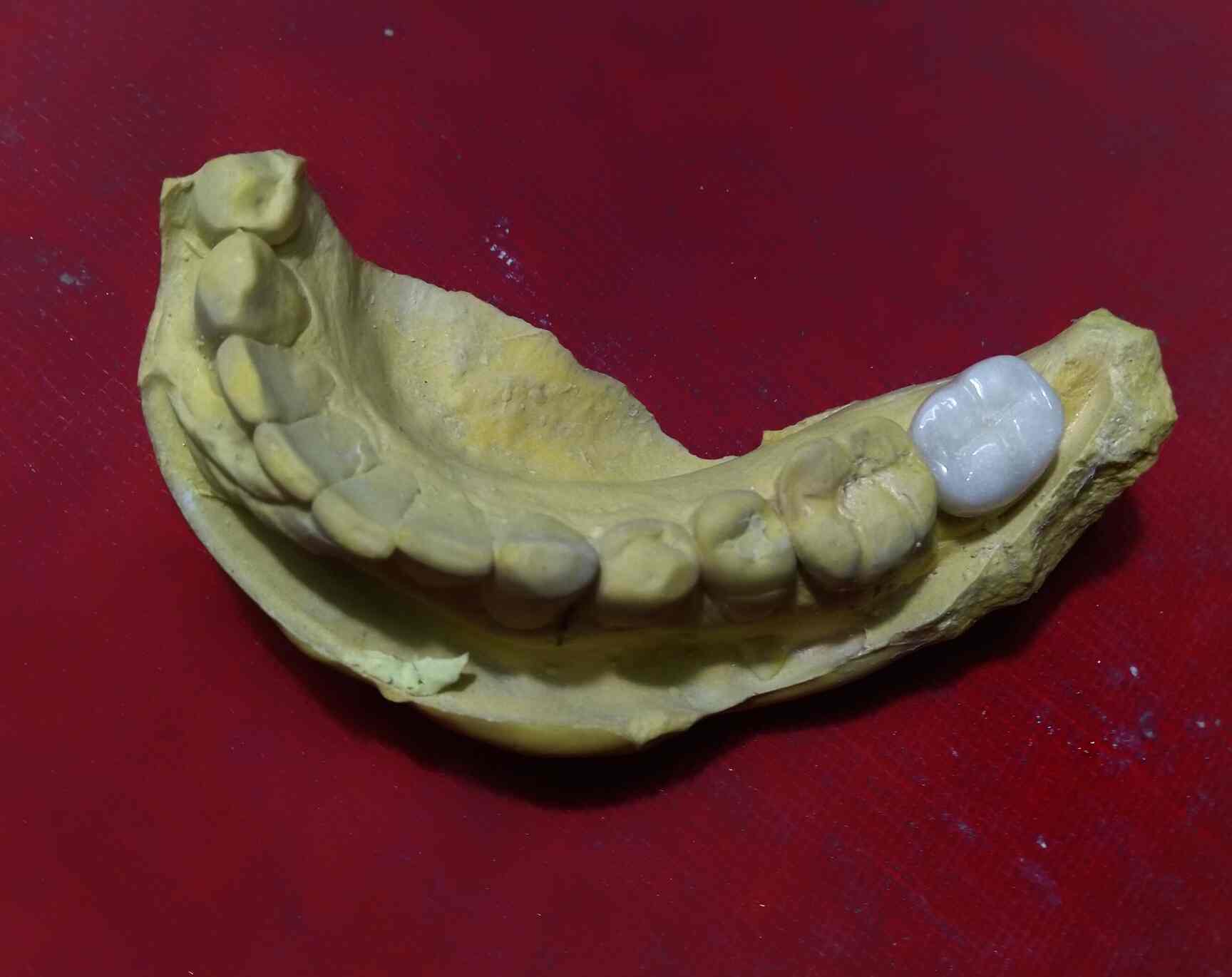 Top Dental Laboratory in Dombivli West Best Dental Labs Mumbai near