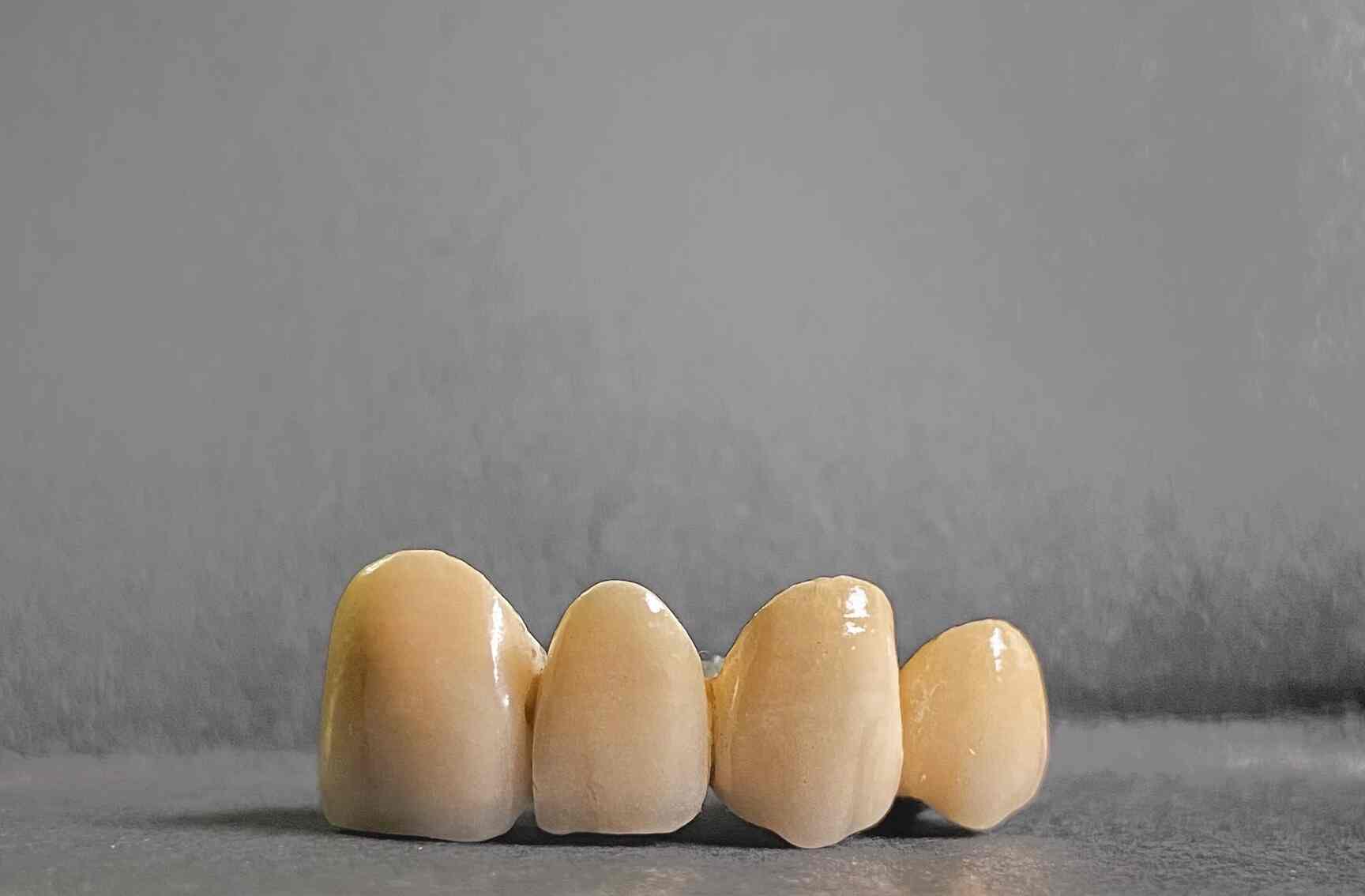 Top Dental Laboratory in Dombivli West Best Dental Labs Mumbai near