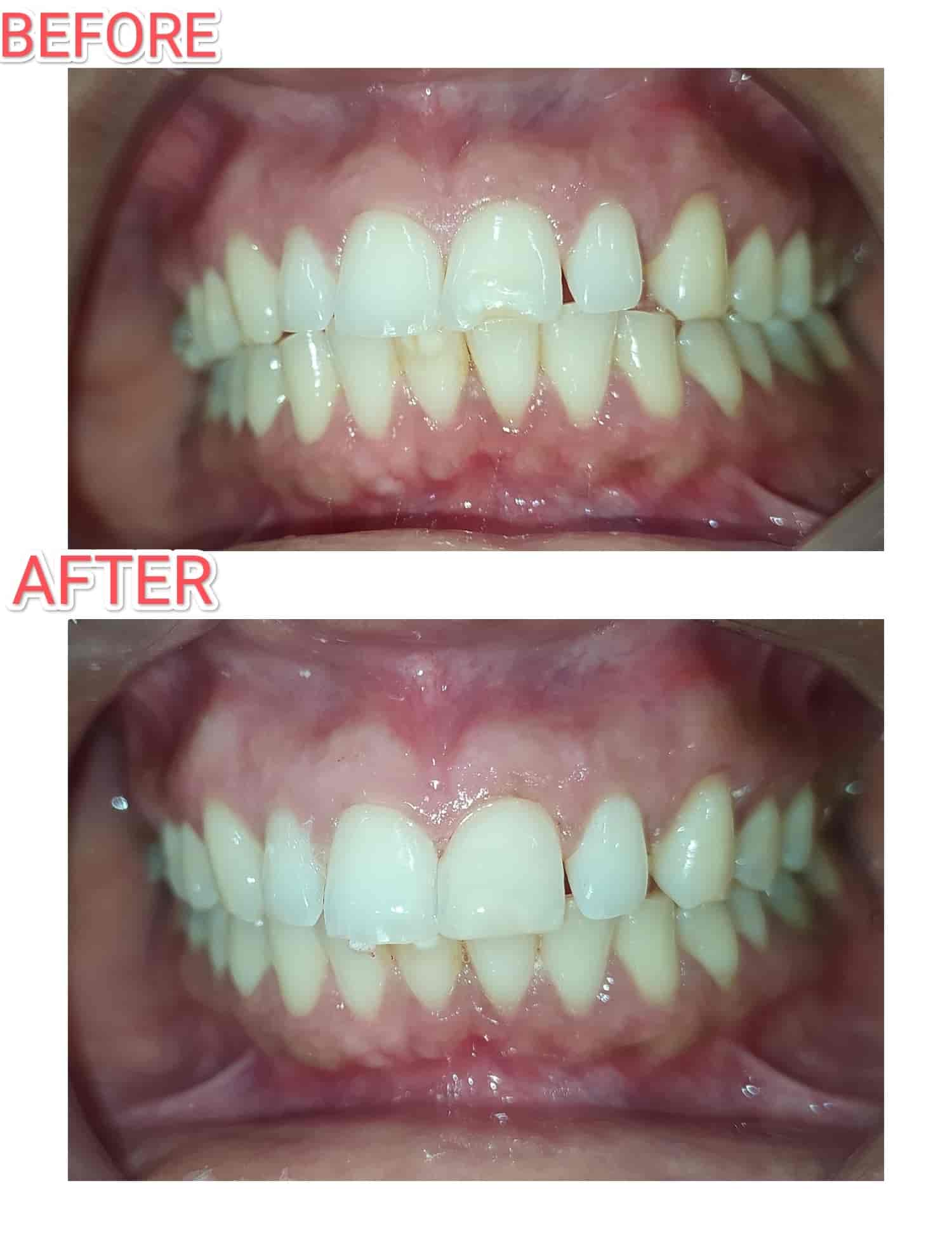 Tooth World Dental Clinic in Thiruvalla,Pathanamthitta Best Dental