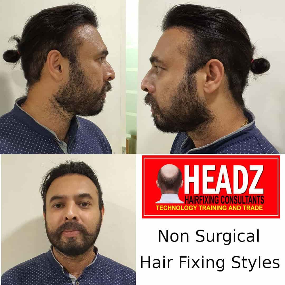 Share 145+ headz hair fixing trivandrum tnbvietnam.edu.vn