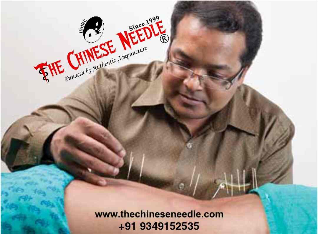 List Of Best Acupuncture Doctors in Peroorkkada Best Acupuncture