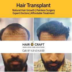 HAIR O CRAFT in Kuriachira - Best Hair Treatment Clinics in Thrissur - Justdial HAIR O CRAFT in Kuriachira - Best Hair Treatment Clinics in Thrissur - Justdial