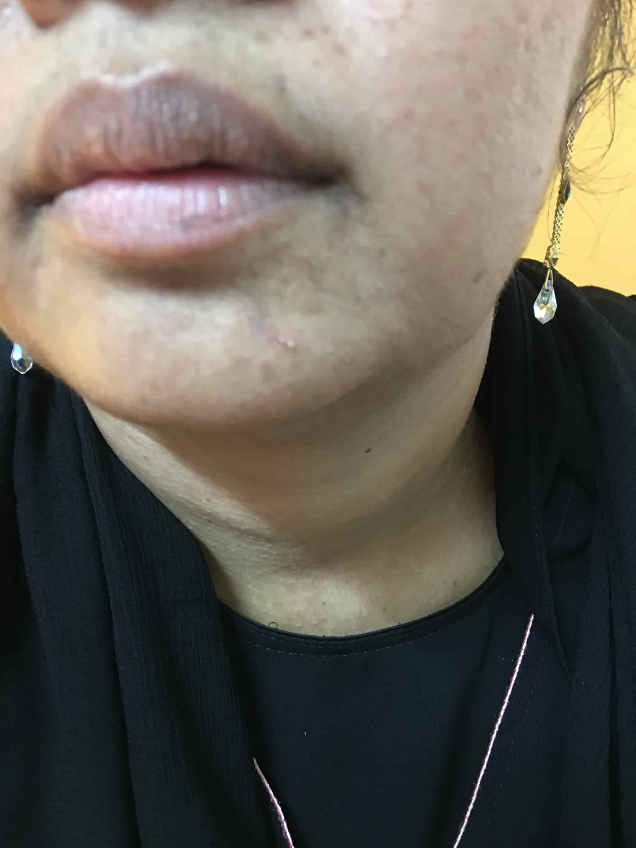 Surya Skin & Hair Hospital in Doddapuram Street,Tirupati Best Skin