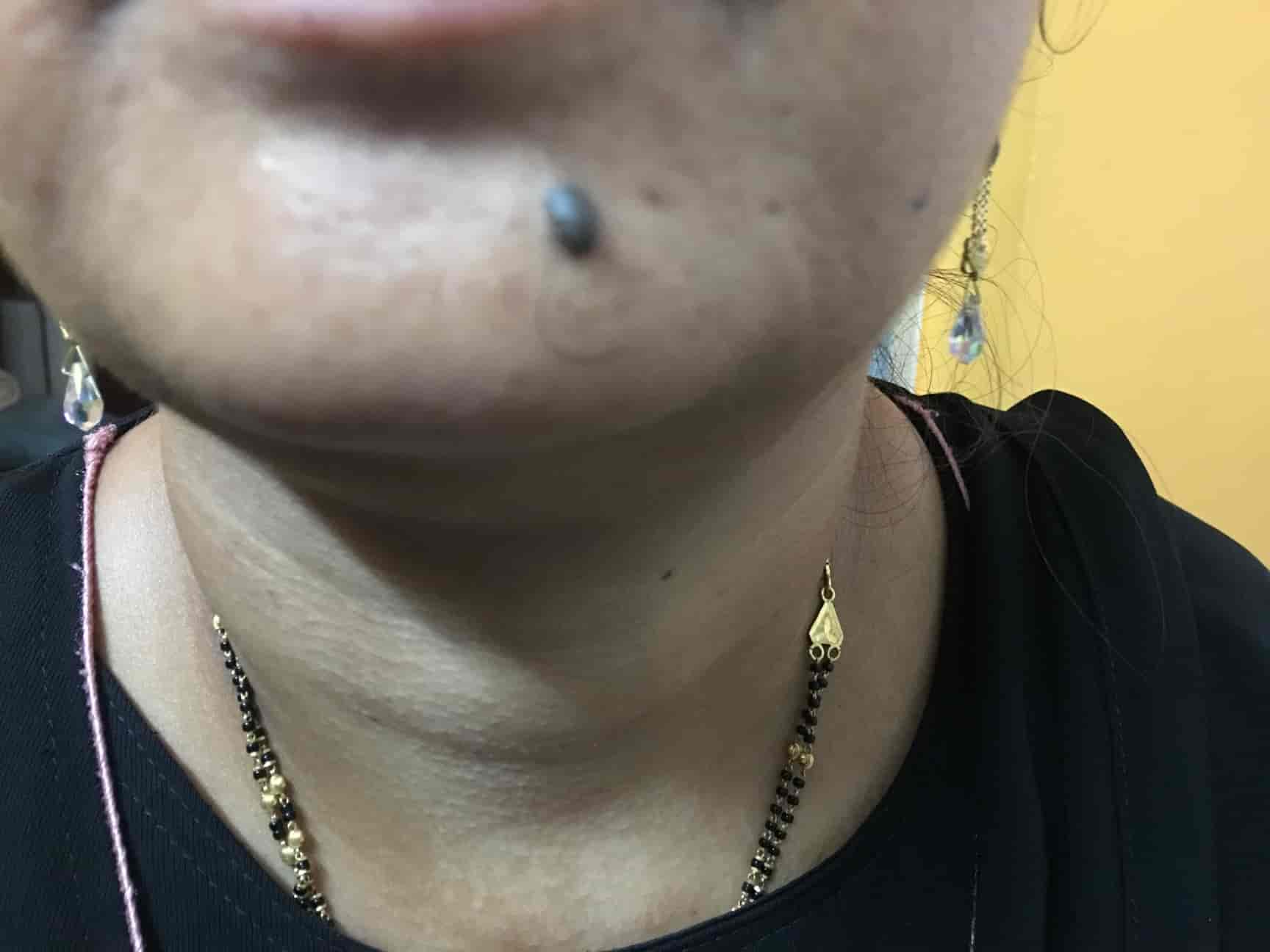 Surya Skin & Hair Hospital in Doddapuram Street,Tirupati Best Skin