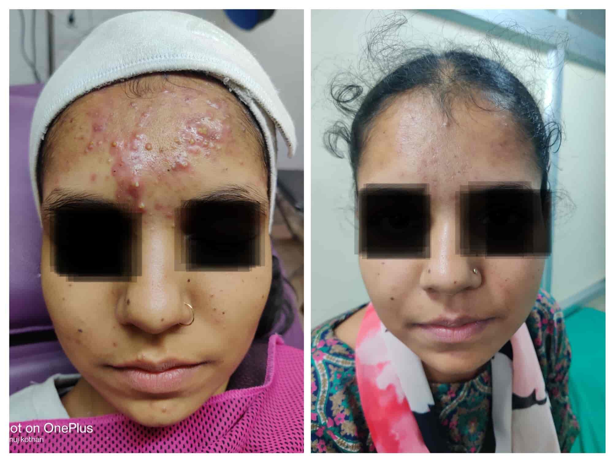 Top Dermatologists in UdaipurRajasthan Best Skin Specialist near me