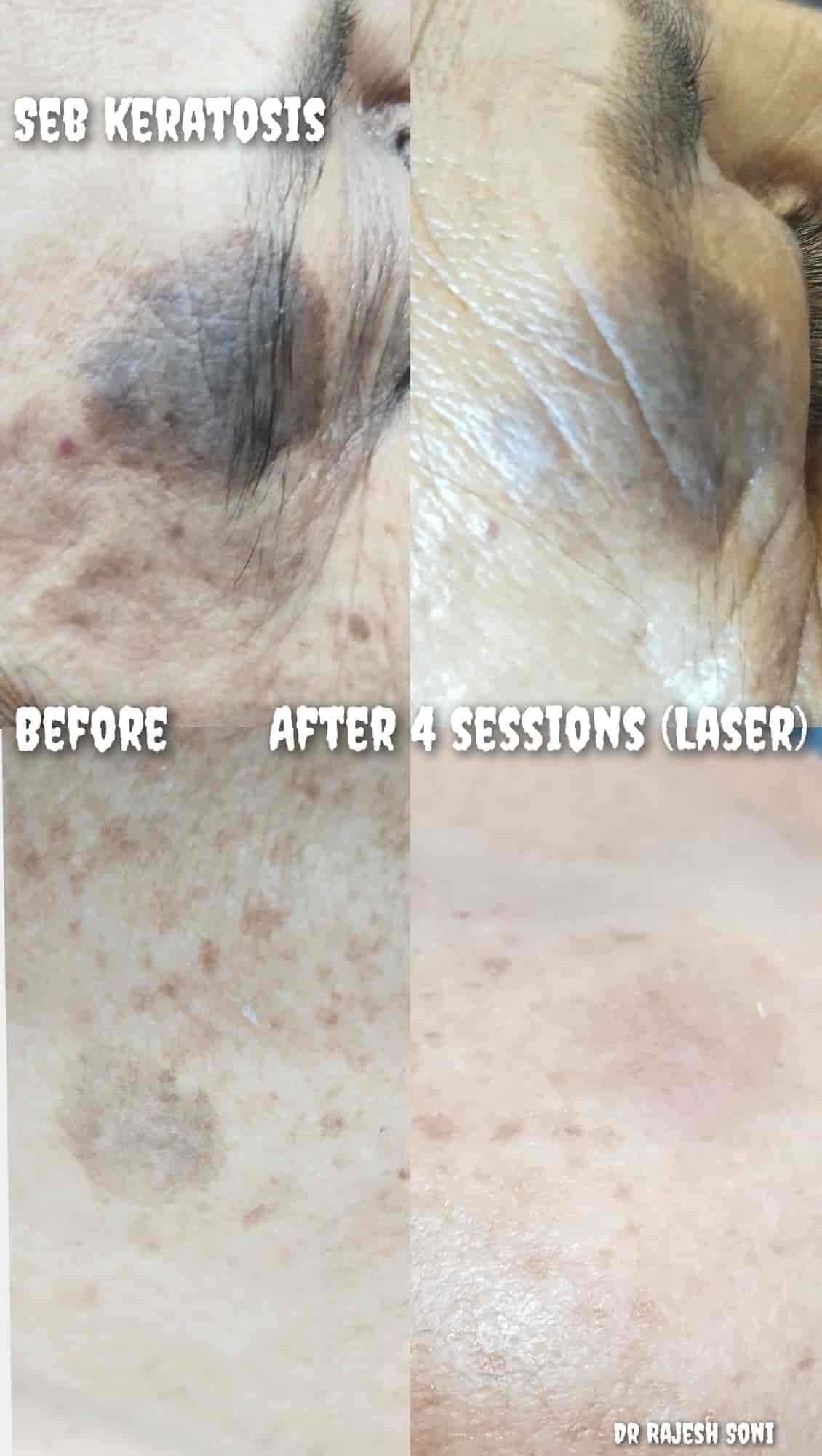 Top Dermatologists in UdaipurRajasthan Best Skin Specialist near me