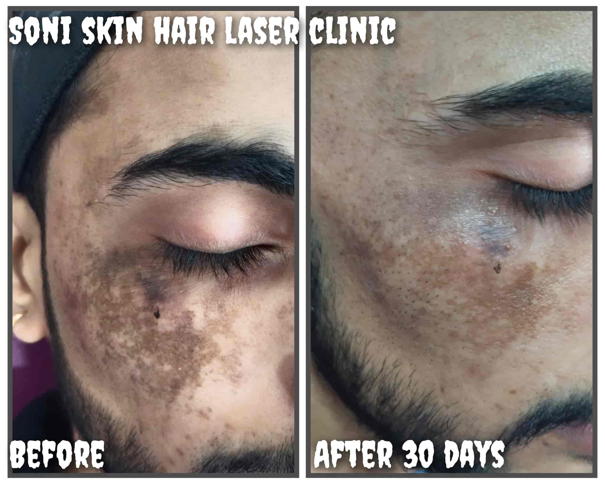 Top Dermatologists in UdaipurRajasthan Best Skin Specialist near me