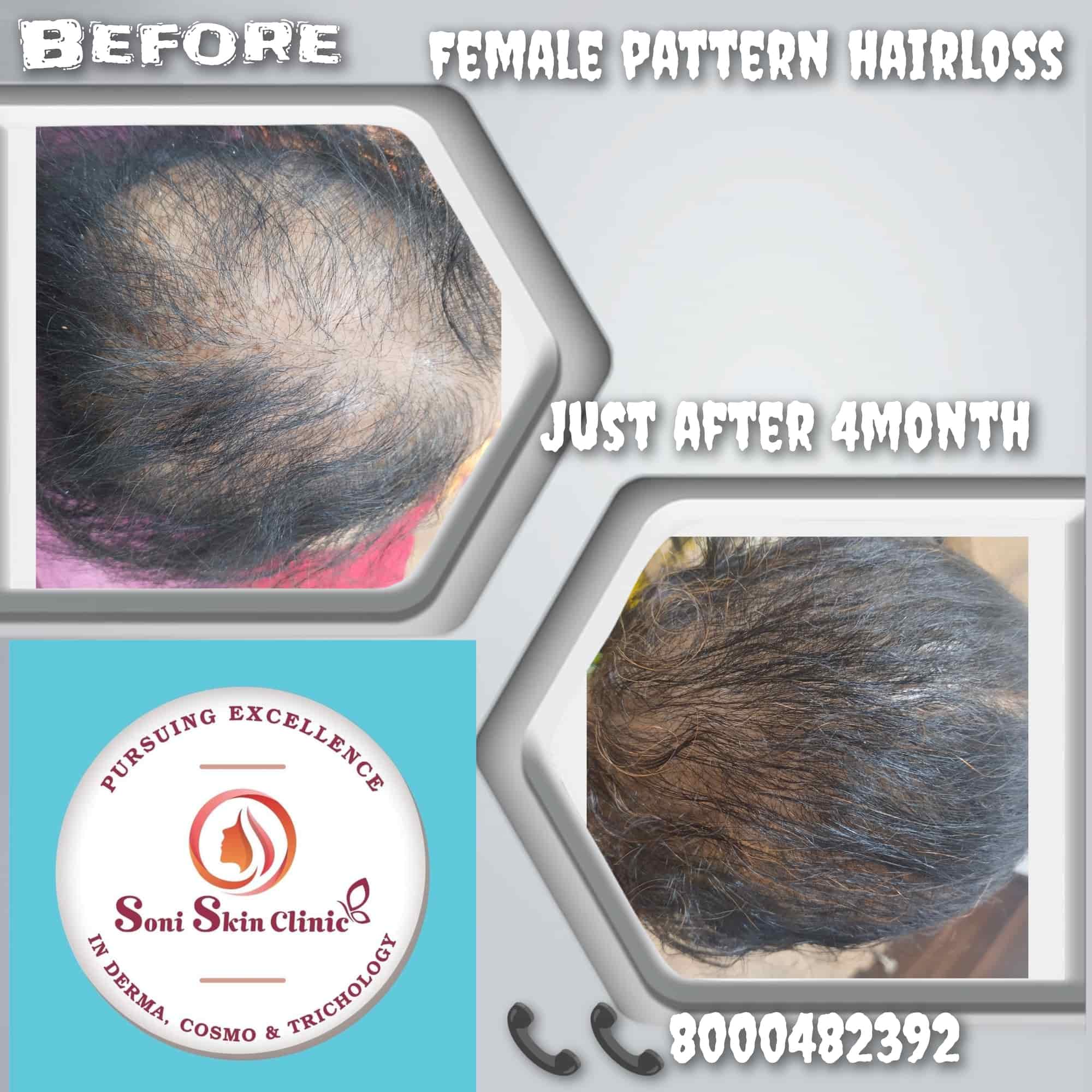 Top Dermatologists in Udaipur-Rajasthan - Best Skin Specialist near me