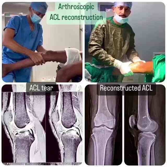 Dr. Ankur Parikh Orthopedic Surgeon in Vip Road,Vadodara Best