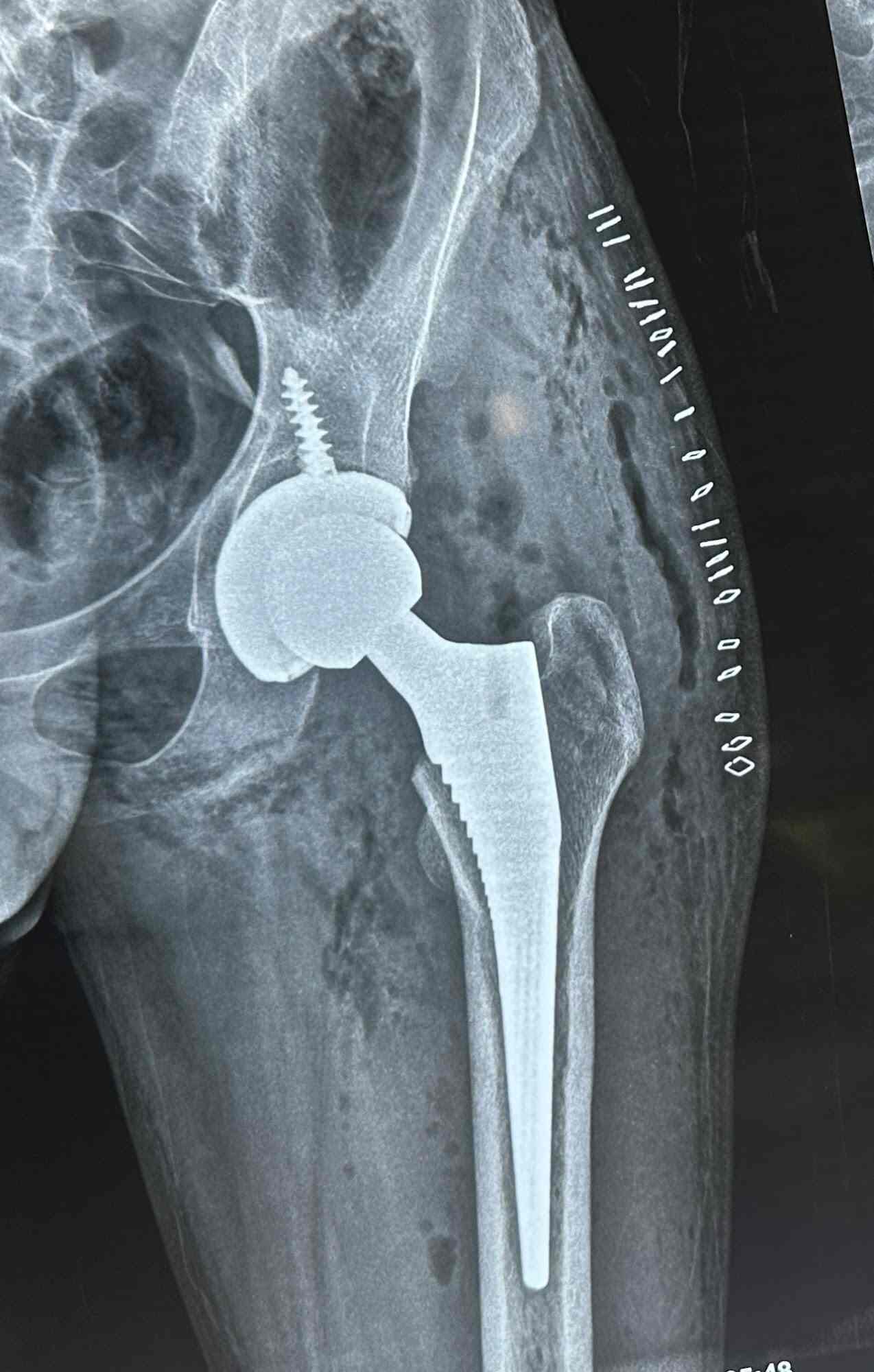 Dr. Ankur Parikh Orthopedic Surgeon in Vip Road,Vadodara Best