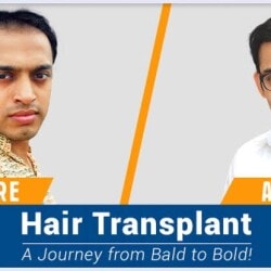 Richfeel Hair and Scalp Clinic in Diwalipura - Best Hair Treatment Clinics in Vadodara - Justdial Richfeel Hair and Scalp Clinic in Diwalipura - Best Hair Treatment Clinics in Vadodara - Justdial