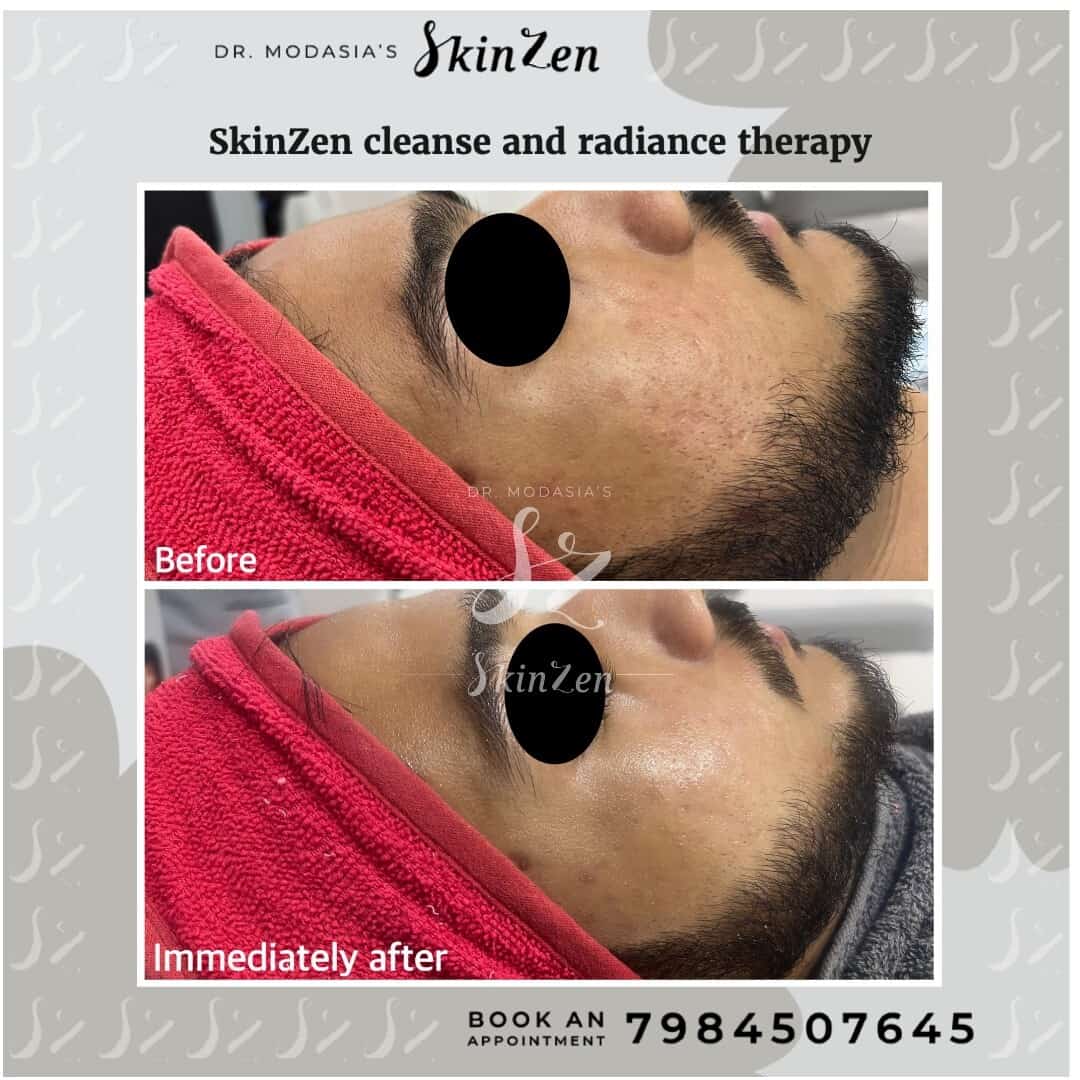 Top Dermatologists in Marvad, Daman Best Skin Specialist near me