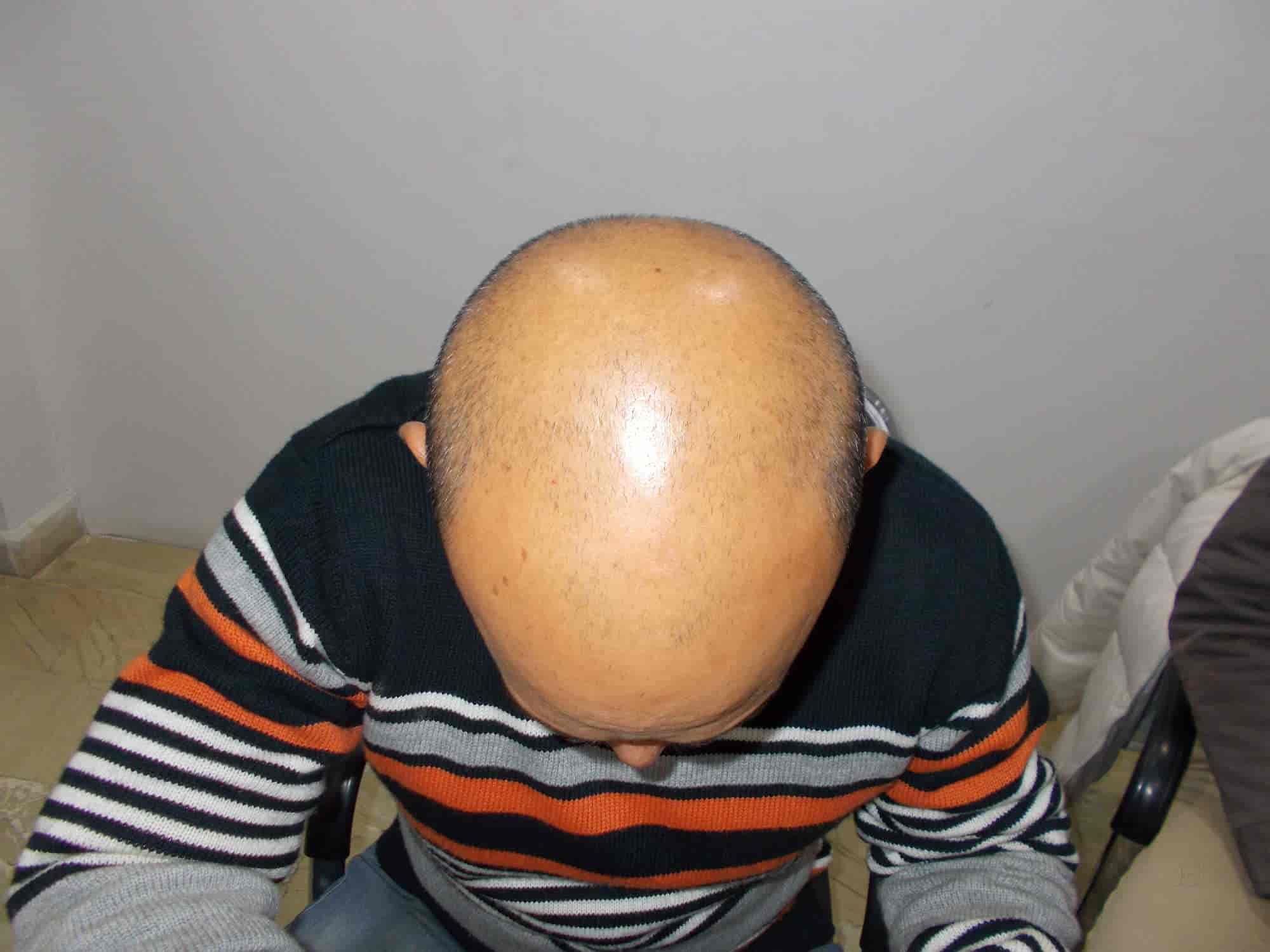 Top Dermatologists in Cantonment RoadVaranasi Cantt, Varanasi Best Skin Specialist near me