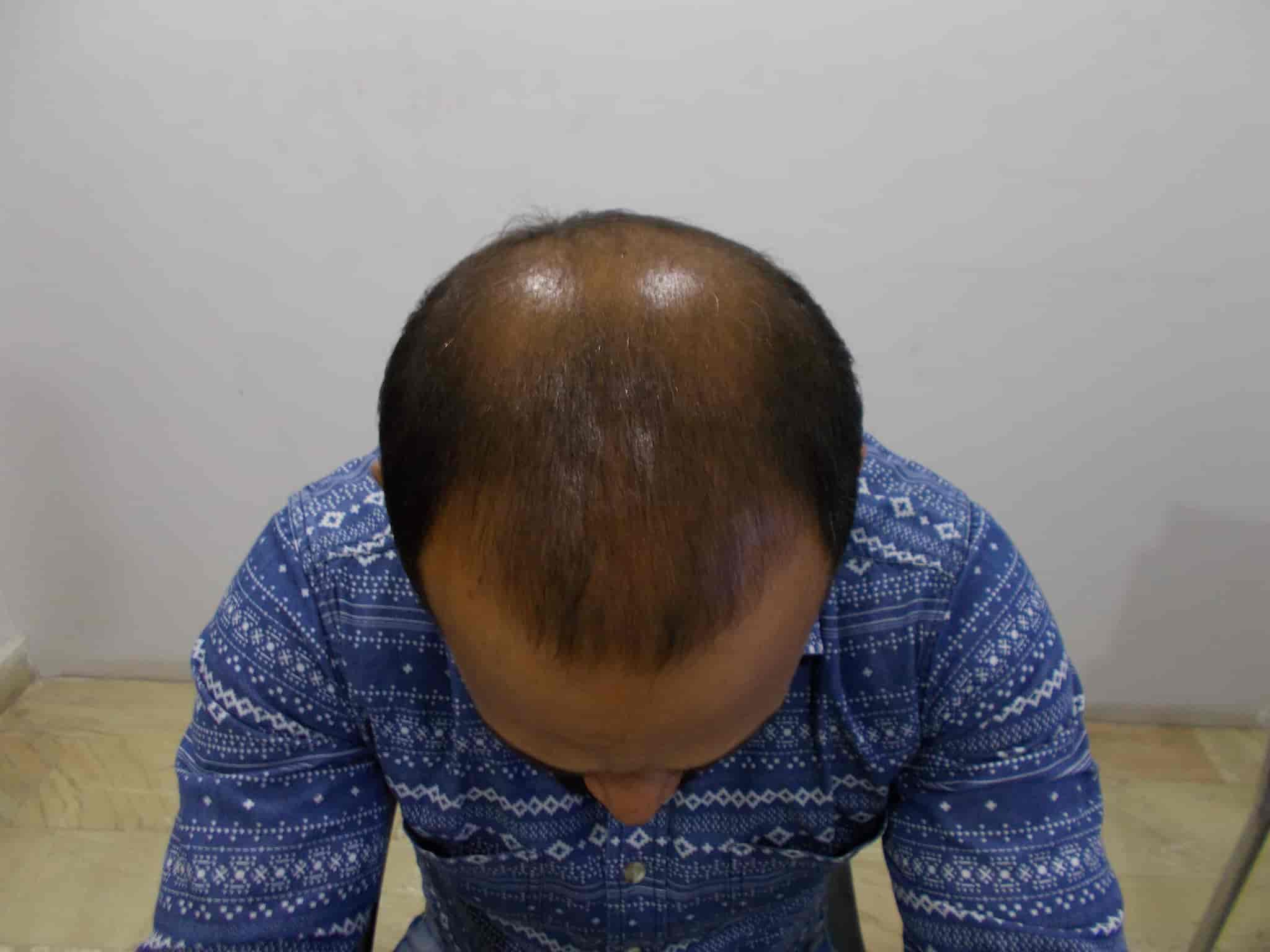 Top Dermatologists in Cantonment RoadVaranasi Cantt, Varanasi Best Skin Specialist near me