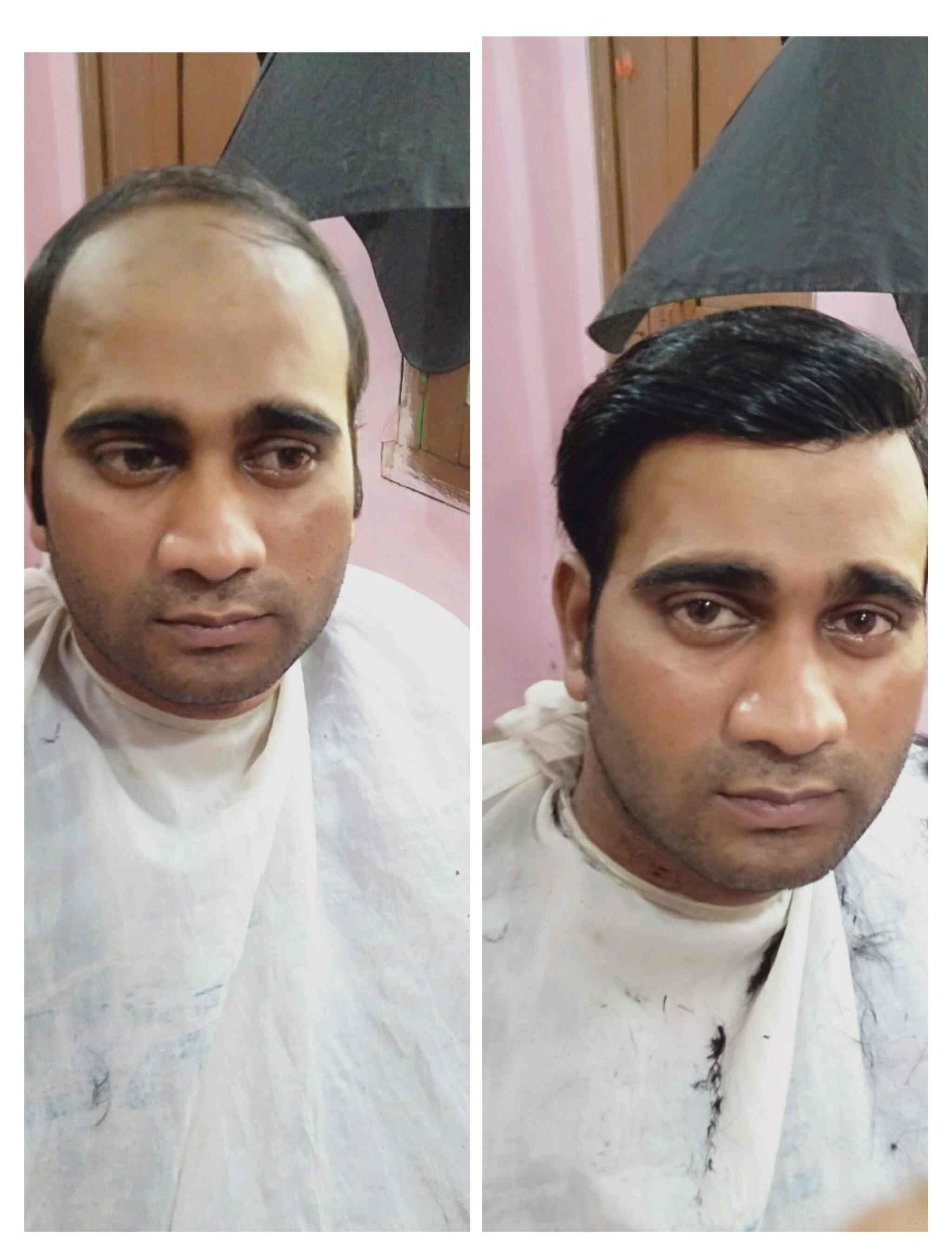 Top Hair Weaving Services In Varanasi Fix Your Baldness Justdial