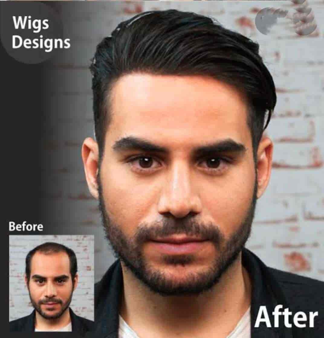 Discover more than 149 hair wig in varanasi latest tnbvietnam.edu.vn