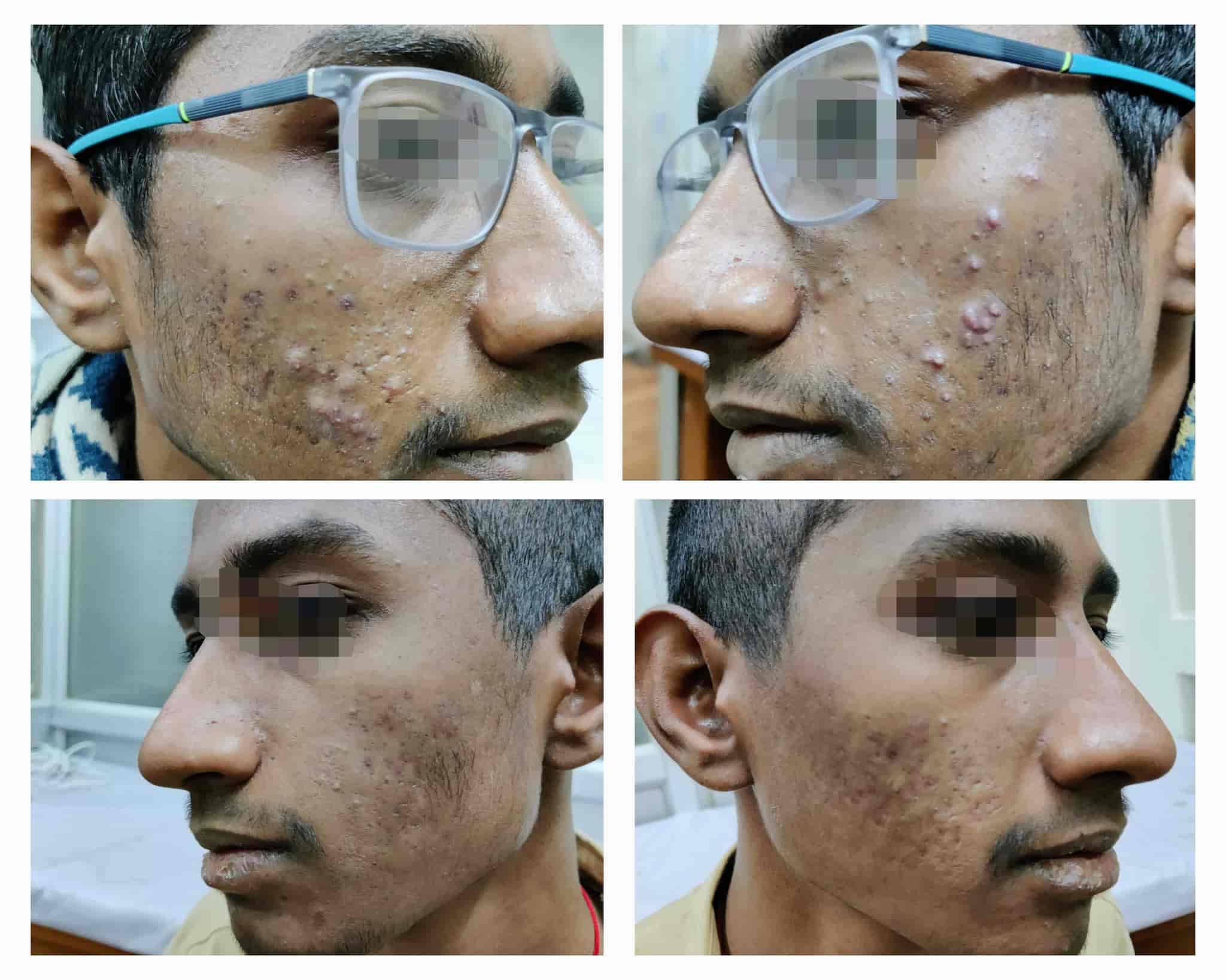 Top Dermatologists in Cantonment RoadVaranasi Cantt, Varanasi Best Skin Specialist near me