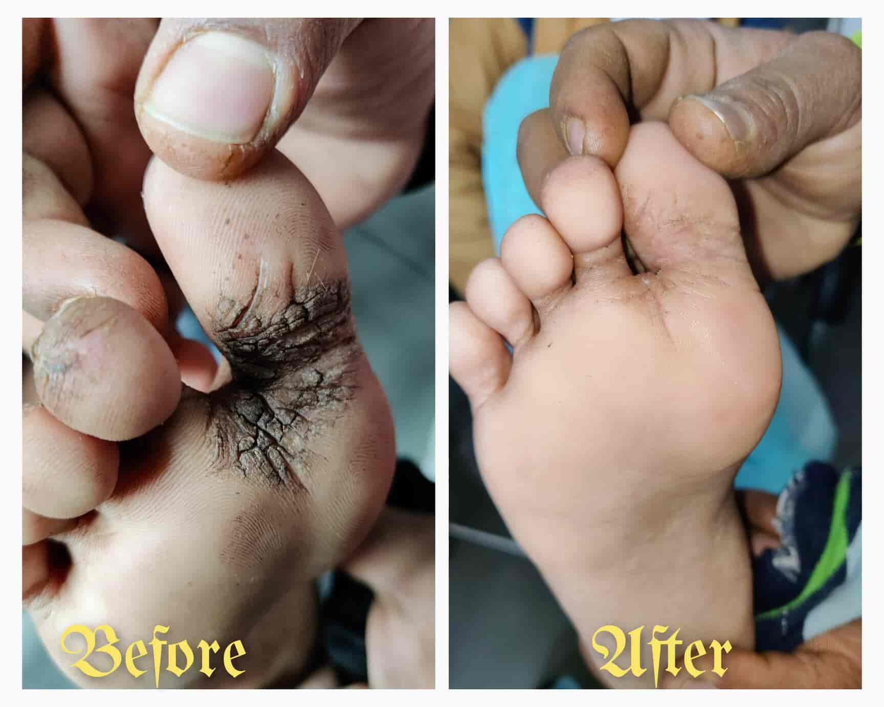 Top Dermatologists in Cantonment RoadVaranasi Cantt, Varanasi Best Skin Specialist near me