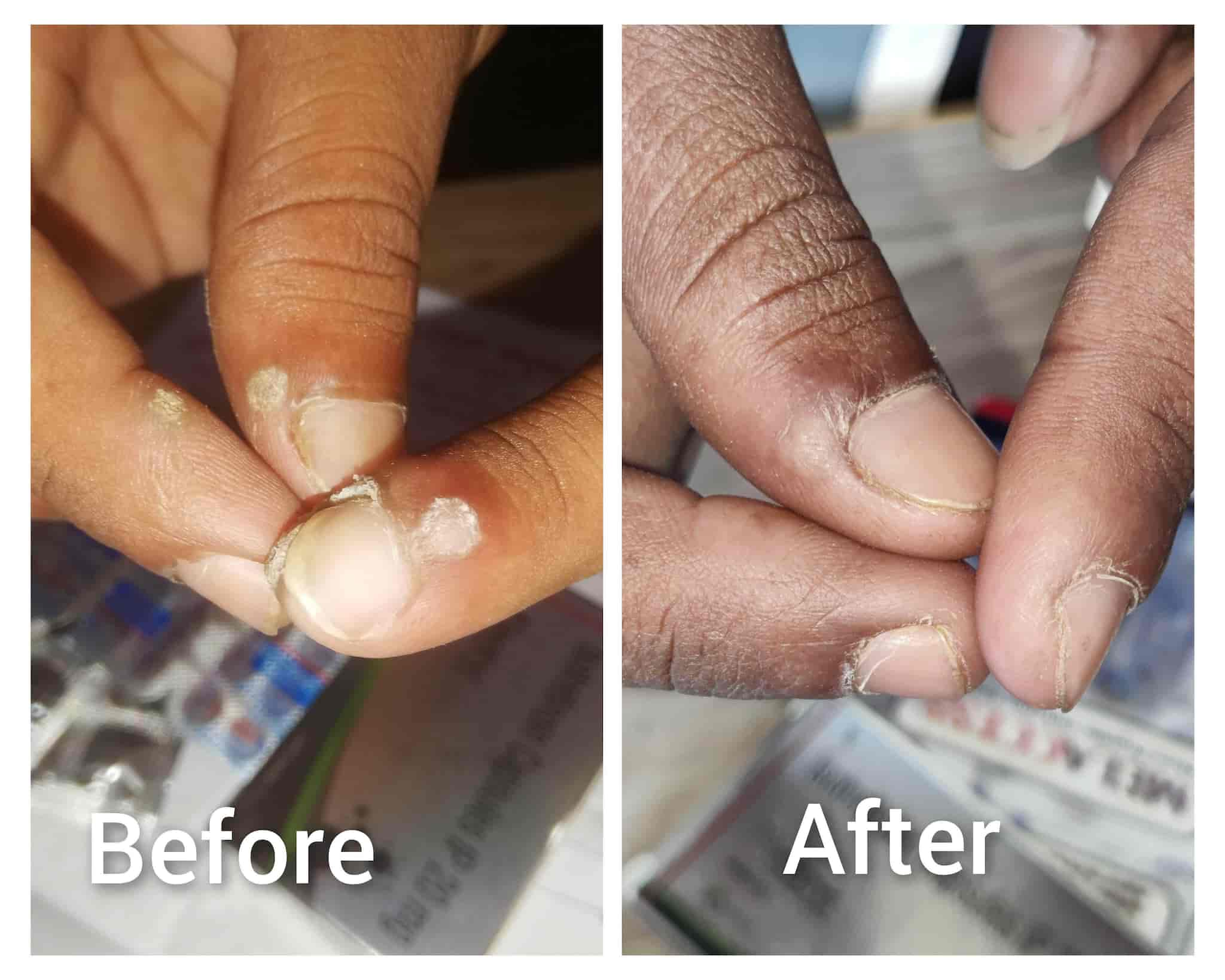 Top Dermatologists in Cantonment RoadVaranasi Cantt, Varanasi Best Skin Specialist near me