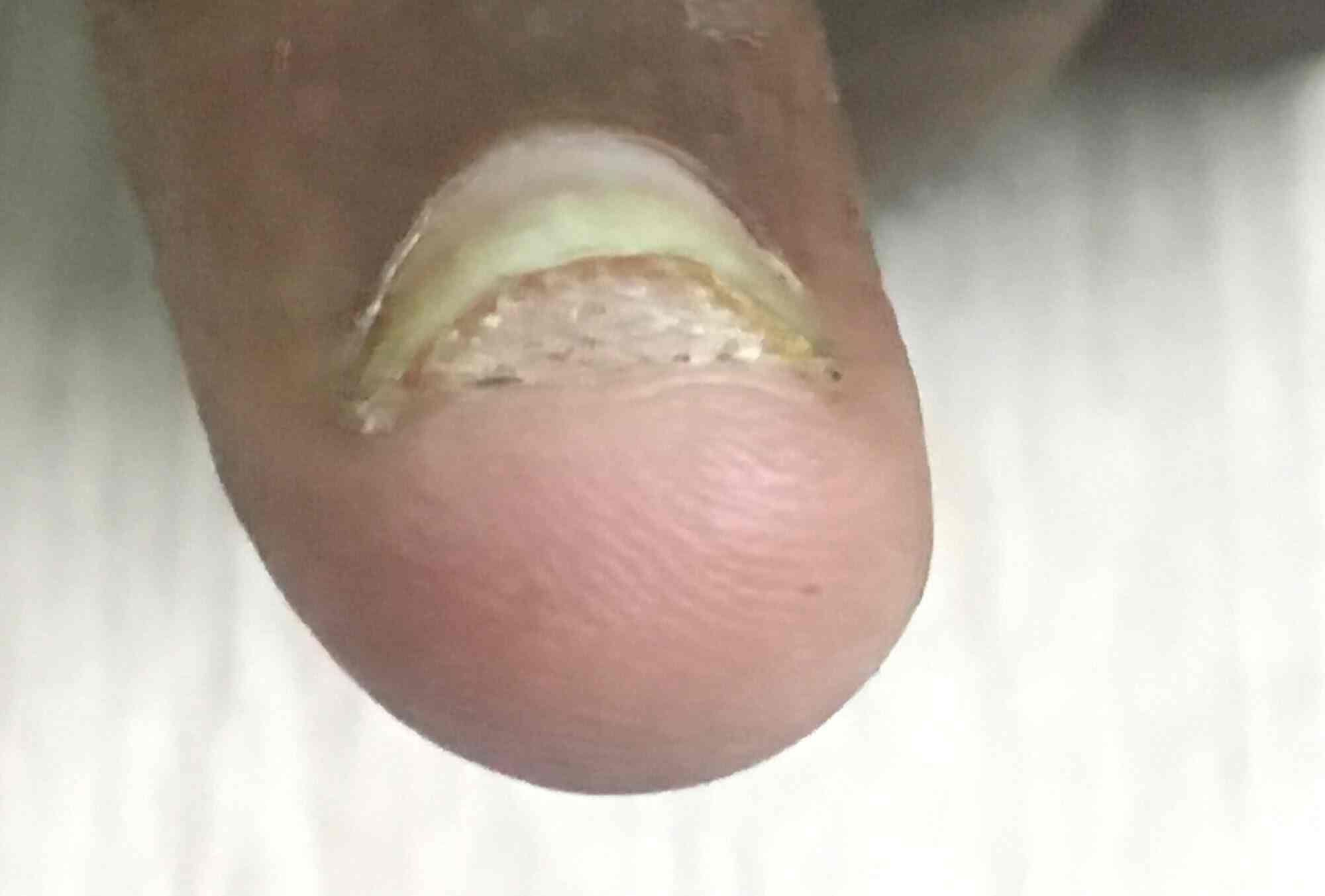 Bhajrang Skin And Cosmotoly Clinic in Gajuwaka,Visakhapatnam Best