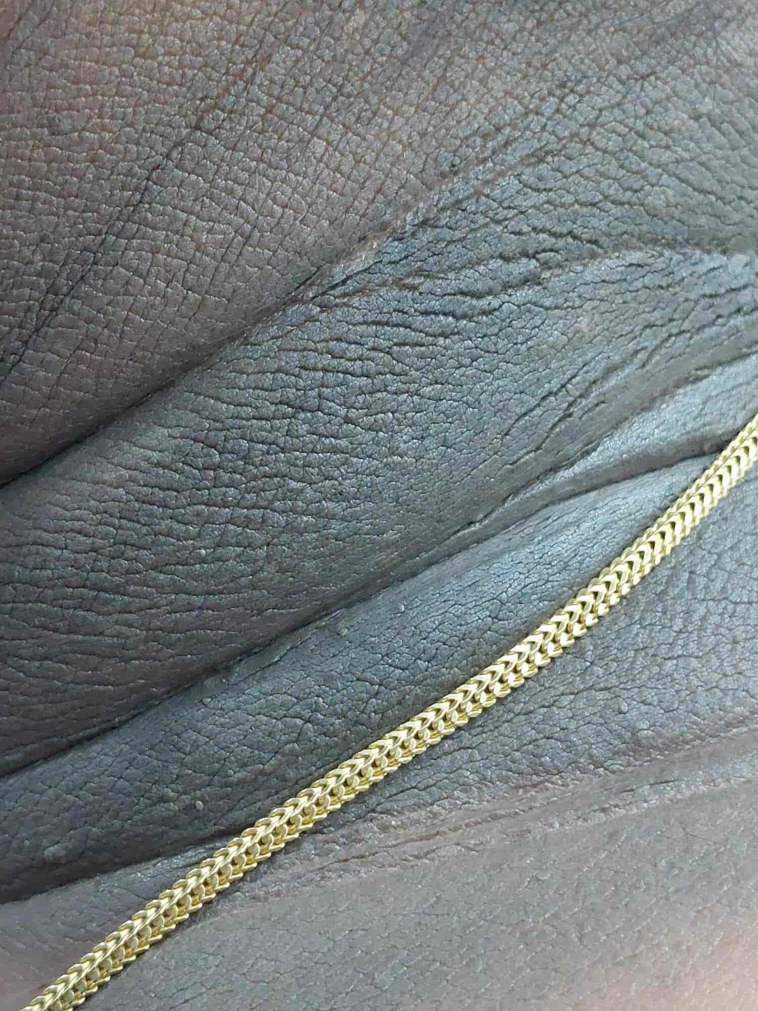 Bhajrang Skin And Cosmotoly Clinic in Gajuwaka,Visakhapatnam Best