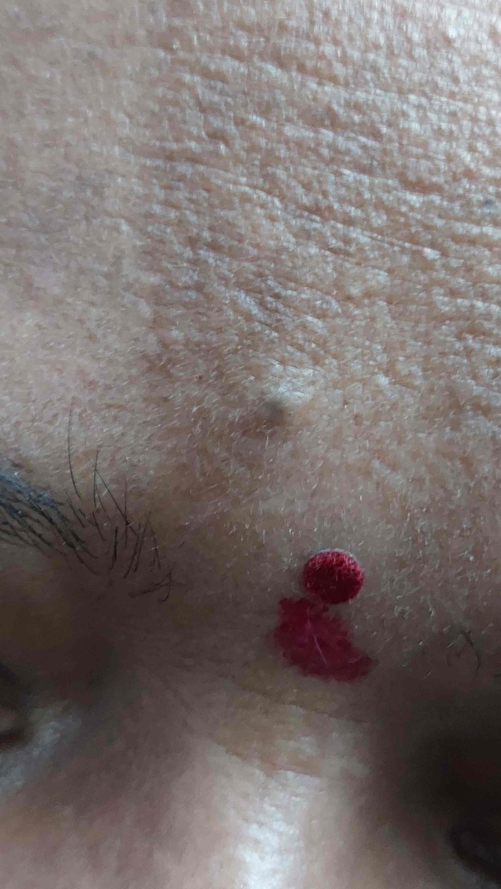 Bhajrang Skin And Cosmotoly Clinic in Gajuwaka,Visakhapatnam Best