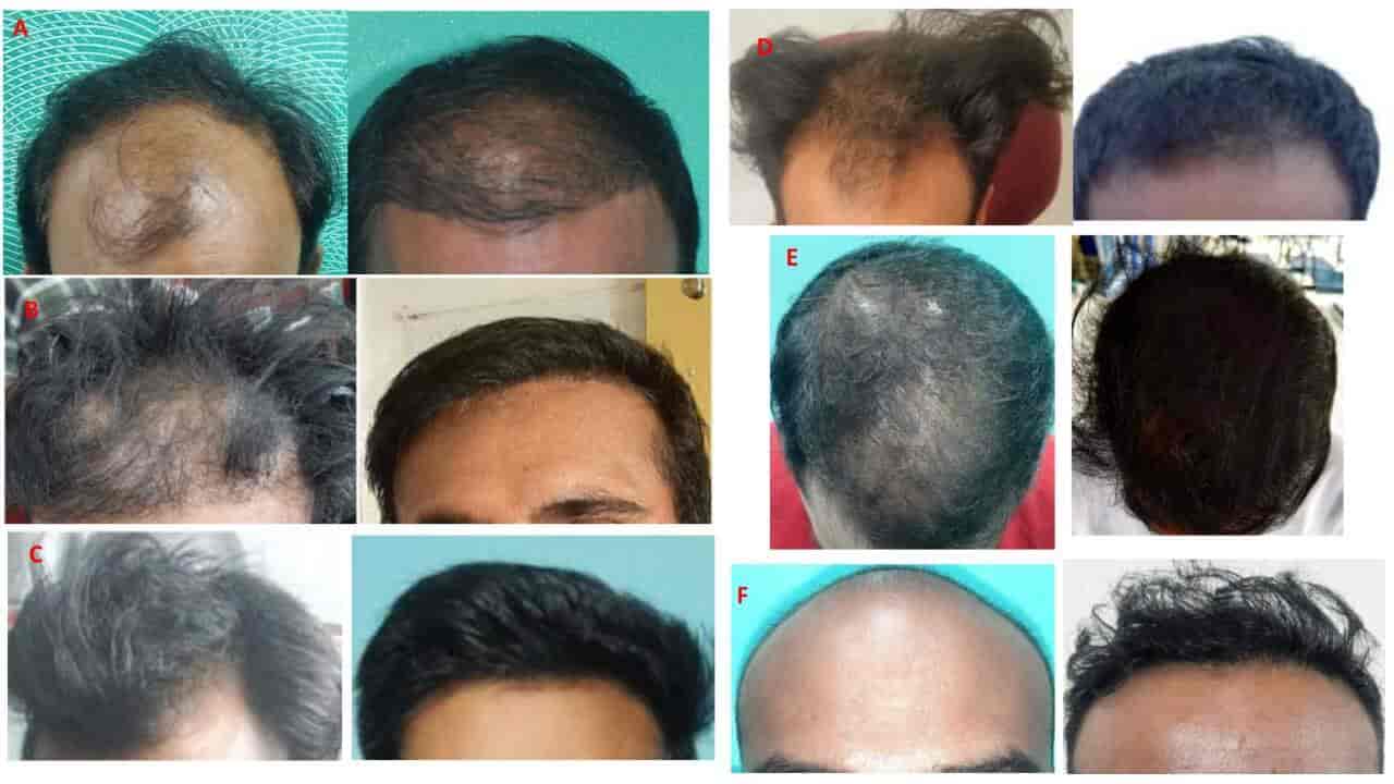 Top Dermatologists in Koruvada, Visakhapatnam Best Skin Specialist