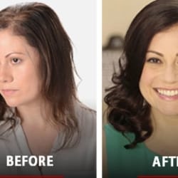 NU STYLE WIGS & HAIR REPLACEMENT STUDIO in Maddilapalem, Visakhapatnam NU STYLE WIGS & HAIR REPLACEMENT STUDIO in Maddilapalem, Visakhapatnam