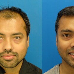 NU STYLE WIGS & HAIR REPLACEMENT STUDIO in Maddilapalem, Visakhapatnam NU STYLE WIGS & HAIR REPLACEMENT STUDIO in Maddilapalem, Visakhapatnam
