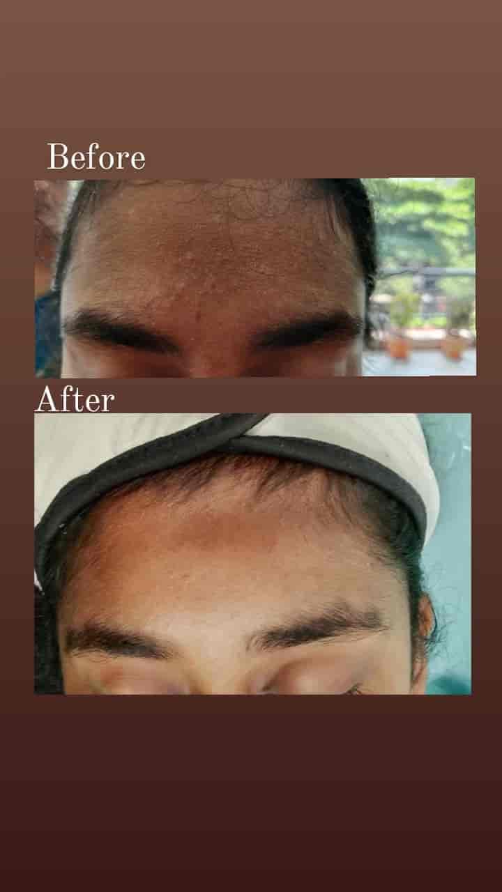 Top Dermatologists in Koruvada, Visakhapatnam Best Skin Specialist