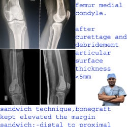 Top Knee Pain Treatment in Vizianagaram near me - Justdial
