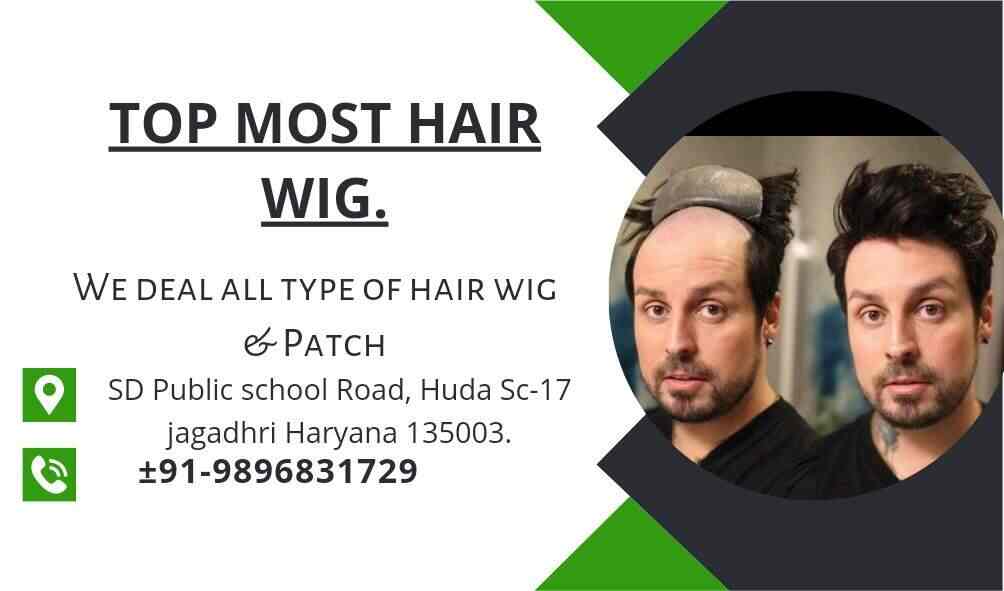 Top Hair Transplant Clinics in Yamunanagar Best Hair Transplant