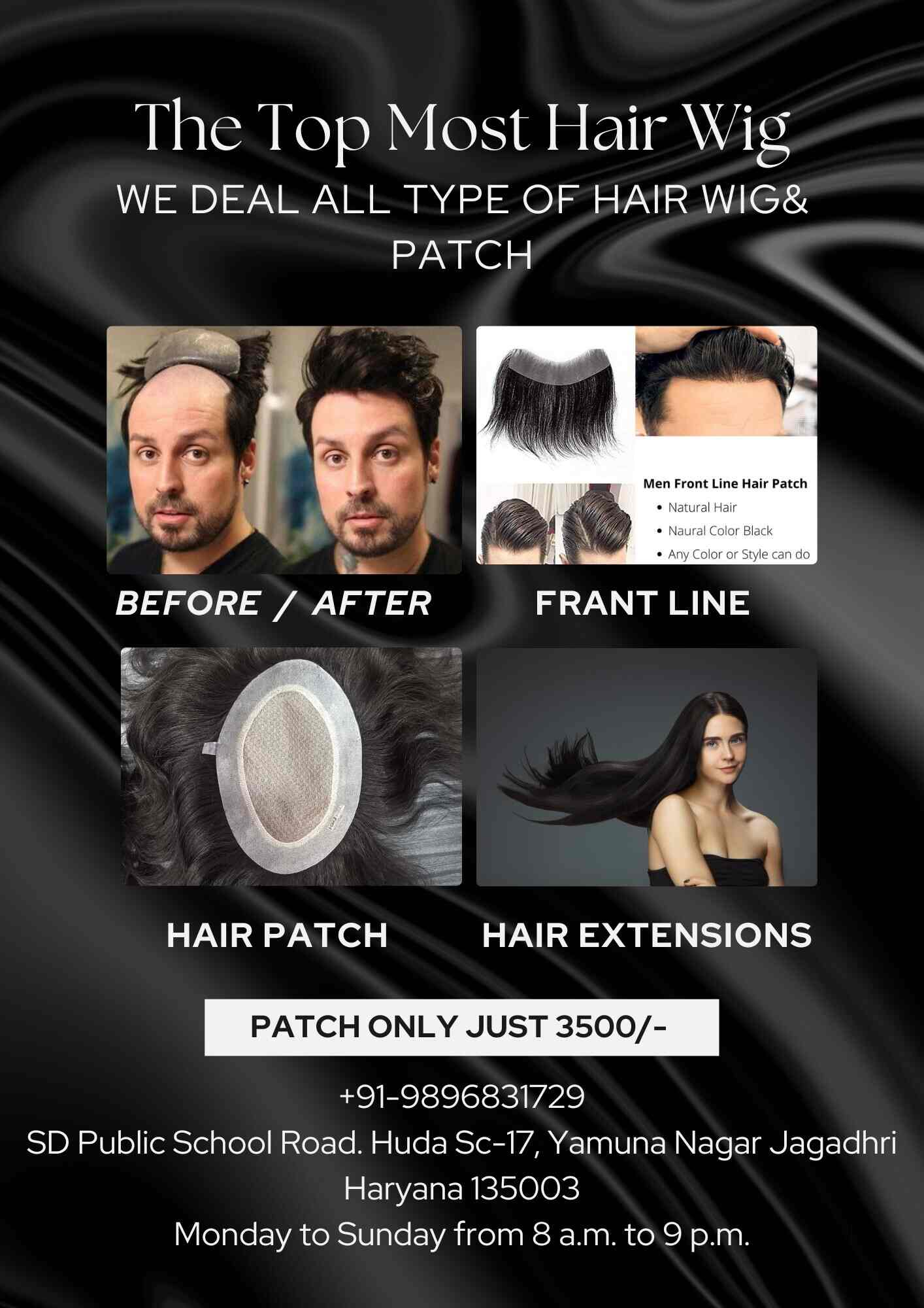 Top Hair Transplant Clinics in Yamunanagar Best Hair Transplant