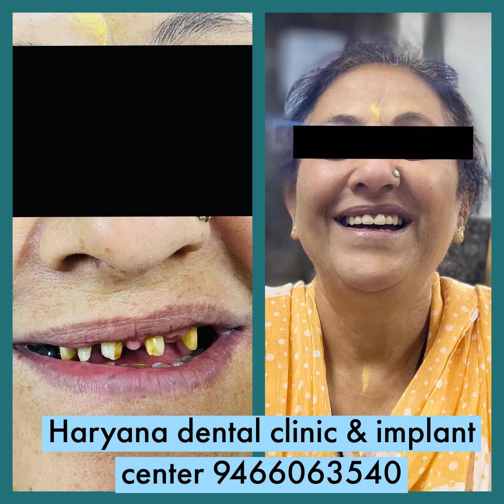 Top Dental Clinics in Yamunanagar near me Justdial