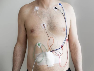 Holter ECG at Home in Bangalore
