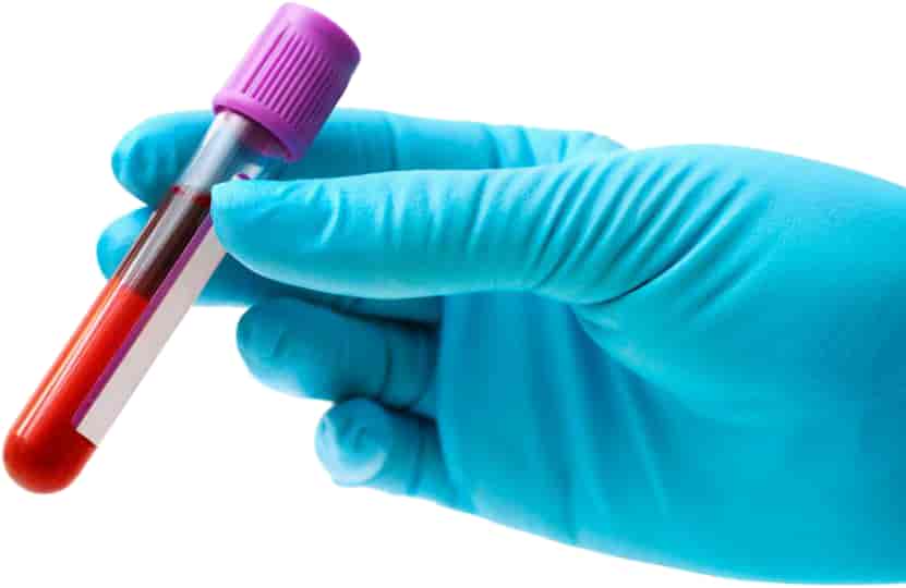 ALL BLOOD TEST